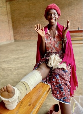 female Patient in a red dress sitting on a bench. Her leg is elevated and the adaptive compression circaid is applied to the lower leg area.