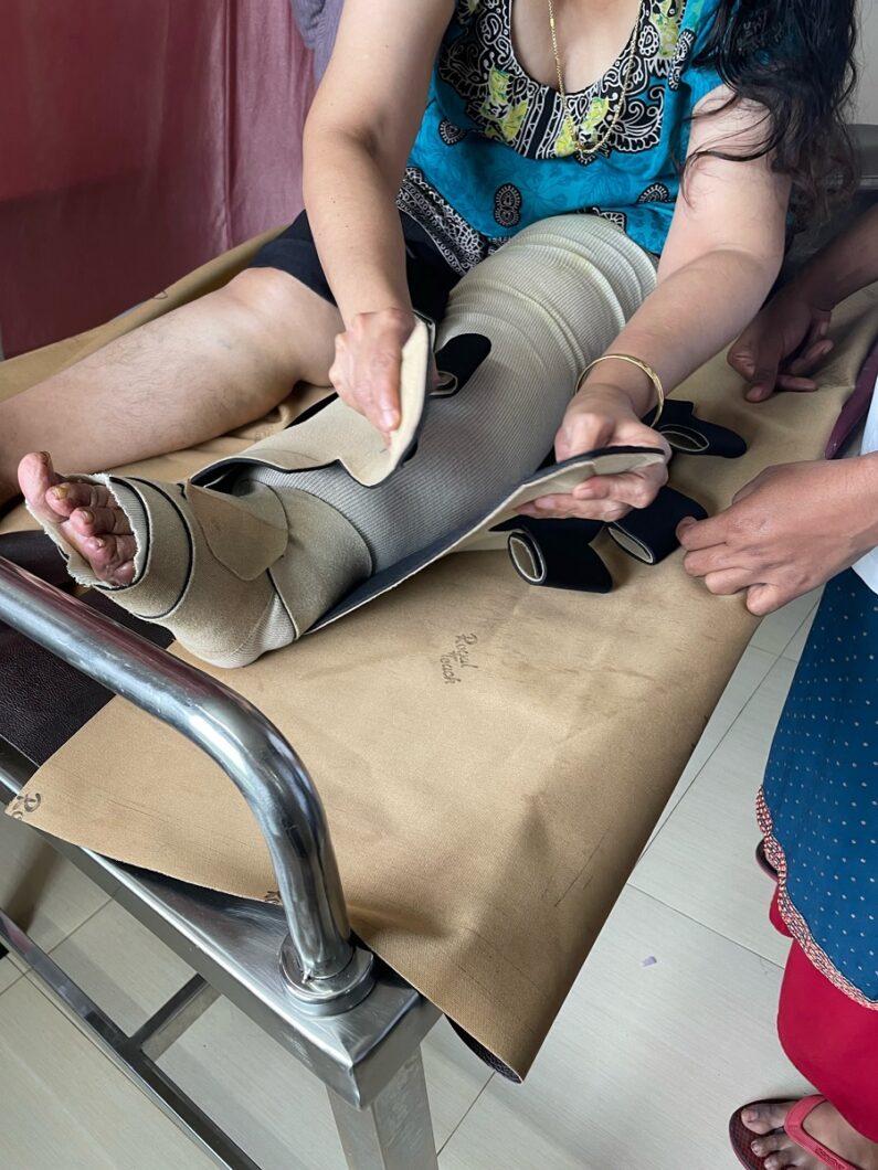 Patientin auf Bett stellt die circaid Kompression am linken Bein passgenau ein.