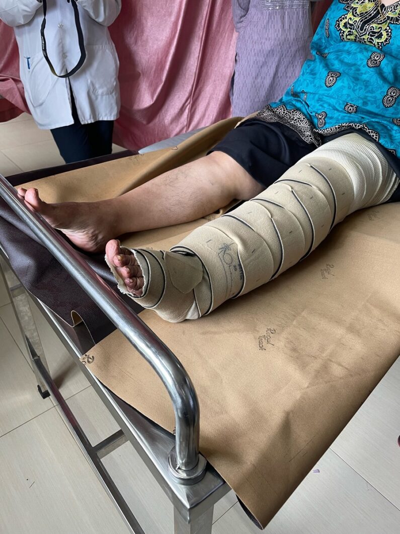 Die circaid Kompression am linken Bein der Patientin ist fertig angelegt.